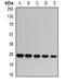 Proteasome Subunit Alpha 6 antibody, orb340832, Biorbyt, Western Blot image 
