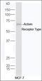 Activin A Receptor Type 2B antibody, orb155589, Biorbyt, Western Blot image 