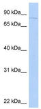 Kinesin-like protein KIF2C antibody, TA334694, Origene, Western Blot image 