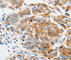 ADP Ribosylation Factor 6 antibody, A3162, ABclonal Technology, Immunohistochemistry paraffin image 
