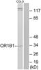 Olfactory Receptor Family 1 Subfamily B Member 1 (Gene/Pseudogene) antibody, LS-C120829, Lifespan Biosciences, Western Blot image 