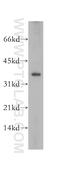 Ribonuclease P/MRP Subunit P38 antibody, 12874-1-AP, Proteintech Group, Western Blot image 