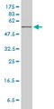Hypoxanthine Phosphoribosyltransferase 1 antibody, LS-C197455, Lifespan Biosciences, Western Blot image 