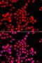 Tau Tubulin Kinase 2 antibody, PA5-76486, Invitrogen Antibodies, Immunofluorescence image 