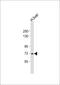 Vitronectin antibody, 62-932, ProSci, Western Blot image 