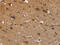 Fyn Related Src Family Tyrosine Kinase antibody, CSB-PA215571, Cusabio, Immunohistochemistry paraffin image 