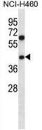 TBC1 Domain Family Member 22A antibody, AP54167PU-N, Origene, Western Blot image 