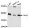 Tribbles Pseudokinase 1 antibody, abx136044, Abbexa, Western Blot image 