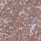 Mitochondrial Ribosomal Protein L30 antibody, NBP2-13614, Novus Biologicals, Immunohistochemistry paraffin image 