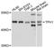 Tryptophan Hydroxylase 1 antibody, LS-B14377, Lifespan Biosciences, Western Blot image 