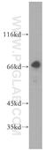 Kelch Like Family Member 20 antibody, 18111-1-AP, Proteintech Group, Western Blot image 