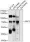 Glypican 3 antibody, 14-390, ProSci, Western Blot image 