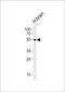Phosphatidylinositol-5-Phosphate 4-Kinase Type 2 Alpha antibody, PA5-72201, Invitrogen Antibodies, Western Blot image 