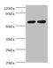 Prolyl 4-Hydroxylase Subunit Alpha 2 antibody, orb352611, Biorbyt, Western Blot image 
