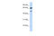 Gamma-Aminobutyric Acid Type A Receptor Gamma2 Subunit antibody, 27-228, ProSci, Western Blot image 