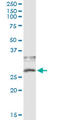 CD79b Molecule antibody, LS-C196867, Lifespan Biosciences, Immunoprecipitation image 