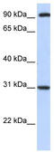 Ankyrin Repeat Family A Member 2 antibody, TA339755, Origene, Western Blot image 