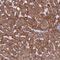 Zinc Finger Protein 248 antibody, NBP2-48540, Novus Biologicals, Immunohistochemistry paraffin image 