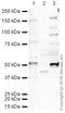 Serpin Family E Member 1 antibody, ab66705, Abcam, Western Blot image 