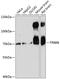 E3 ubiquitin-protein ligase TRIM9 antibody, A08967-1, Boster Biological Technology, Western Blot image 