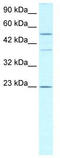 IKAROS Family Zinc Finger 1 antibody, TA331145, Origene, Western Blot image 