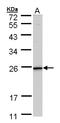 Killer Cell Lectin Like Receptor G1 antibody, LS-C185739, Lifespan Biosciences, Western Blot image 