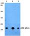 Cytochrome B-245 Alpha Chain antibody, A03781, Boster Biological Technology, Western Blot image 