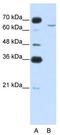Cytoplasmic Polyadenylation Element Binding Protein 2 antibody, TA344026, Origene, Western Blot image 