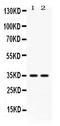 CD58 Molecule antibody, RP1106, Boster Biological Technology, Western Blot image 