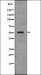 Forkhead Box O3 antibody, orb335940, Biorbyt, Western Blot image 