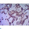 Protein Phosphatase 1 Catalytic Subunit Alpha antibody, LS-C813093, Lifespan Biosciences, Immunohistochemistry paraffin image 