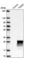 TM2 Domain Containing 2 antibody, PA5-62211, Invitrogen Antibodies, Western Blot image 