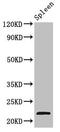 TPD52 Like 2 antibody, LS-C679870, Lifespan Biosciences, Western Blot image 