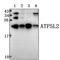 ATP Synthase Membrane Subunit G Like antibody, PA5-75985, Invitrogen Antibodies, Western Blot image 