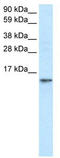 Fatty acid-binding protein, brain antibody, TA334290, Origene, Western Blot image 