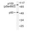 Nuclear factor NF-kappa-B p105 subunit antibody, AP01645PU-N, Origene, Western Blot image 