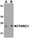 Collagen Triple Helix Repeat Containing 1 antibody, PA5-38054, Invitrogen Antibodies, Western Blot image 