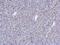 ATM Serine/Threonine Kinase antibody, GTX70105, GeneTex, Immunohistochemistry paraffin image 