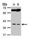 Acyl-CoA Thioesterase 8 antibody, PA5-27973, Invitrogen Antibodies, Western Blot image 