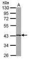 Beta-1,4-Galactosyltransferase 5 antibody, GTX118066, GeneTex, Western Blot image 