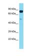 Chromosome 11 Open Reading Frame 1 antibody, orb326722, Biorbyt, Western Blot image 