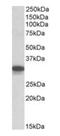 Cytochrome B5 Reductase 3 antibody, orb22552, Biorbyt, Western Blot image 