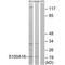 S100 Calcium Binding Protein A16 antibody, PA5-50098, Invitrogen Antibodies, Western Blot image 