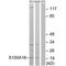 Protein S100-A16 antibody, PA5-50098, Invitrogen Antibodies, Western Blot image 