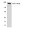 Calcium Voltage-Gated Channel Subunit Alpha1 H antibody, LS-C291749, Lifespan Biosciences, Western Blot image 