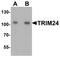 Tripartite Motif Containing 24 antibody, A03258, Boster Biological Technology, Western Blot image 
