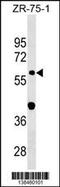 Glycerophosphodiester Phosphodiesterase Domain Containing 2 antibody, 59-864, ProSci, Western Blot image 