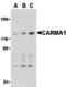 Caspase Recruitment Domain Family Member 11 antibody, A00740, Boster Biological Technology, Western Blot image 