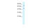 Kelch Like Family Member 25 antibody, 28-118, ProSci, Western Blot image 