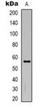Transmembrane Protein 145 antibody, orb319089, Biorbyt, Western Blot image 